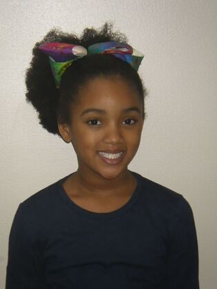 Orthodontics Case 37 - Before