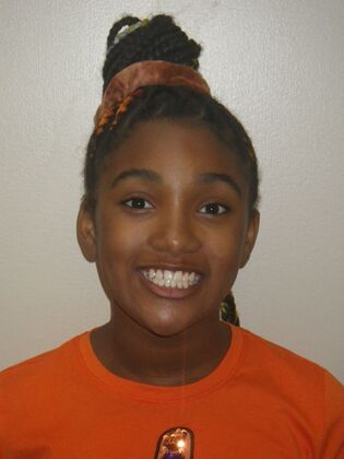 Orthodontics Case 37 - After