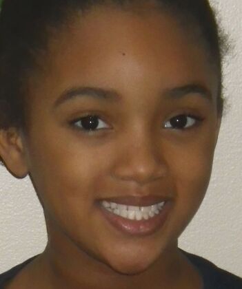 Orthodontics: Case 37 - Before