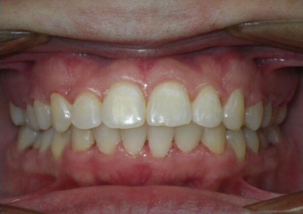 Orthodontics: Case 38 - After