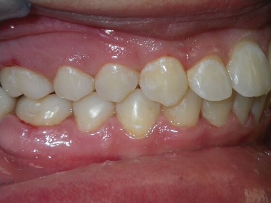 Orthodontics: Case 38 - After