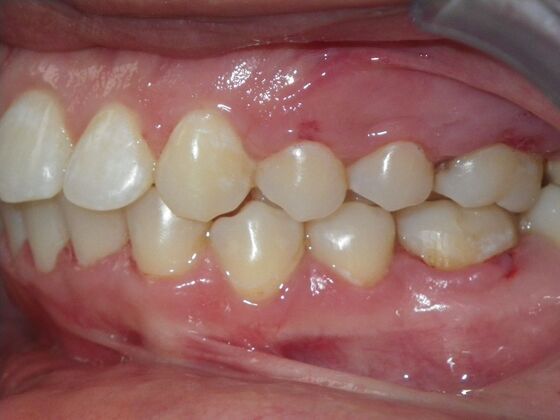 Orthodontics: Case 38 - After