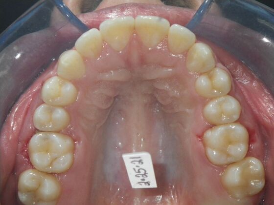 Orthodontics: Case 38 - After