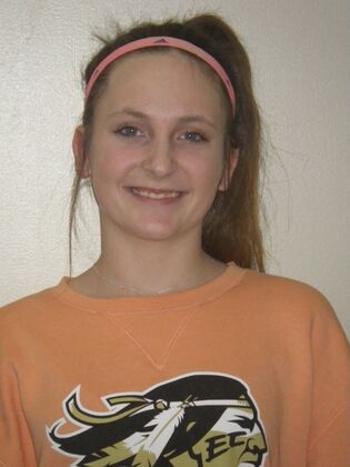 Orthodontics Case 39 - Before