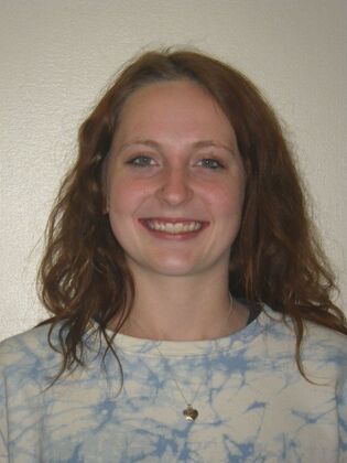 Orthodontics Case 39 - After