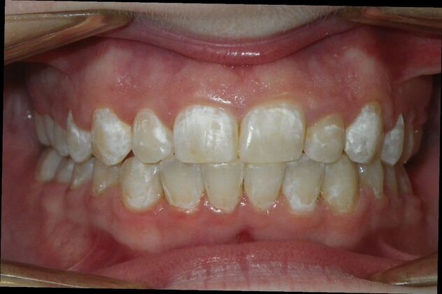 Orthodontics: Case 39 - After