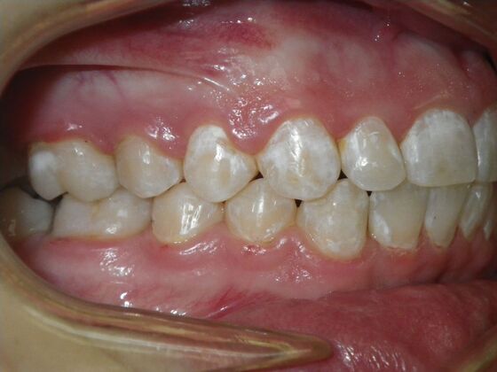 Orthodontics: Case 39 - After