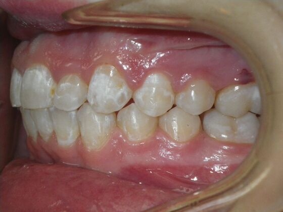 Orthodontics: Case 39 - After