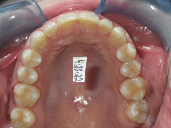 Orthodontics: Case 39 - After