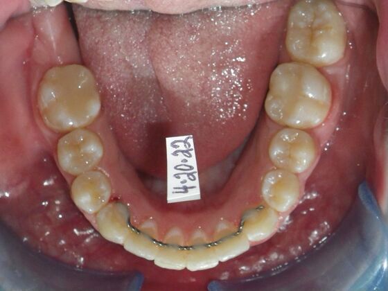 Orthodontics: Case 39 - After