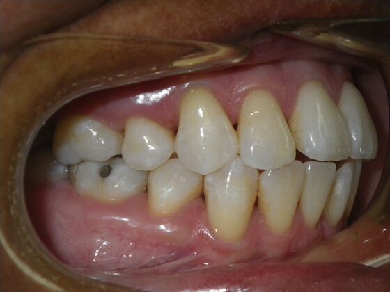 Orthodontics: Case 40 - Before