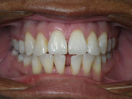 Orthodontics: Case 40 - Before
