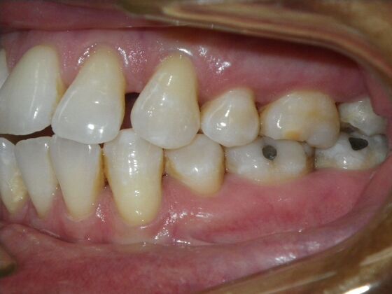 Orthodontics: Case 40 - Before