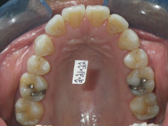 Orthodontics: Case 40 - Before