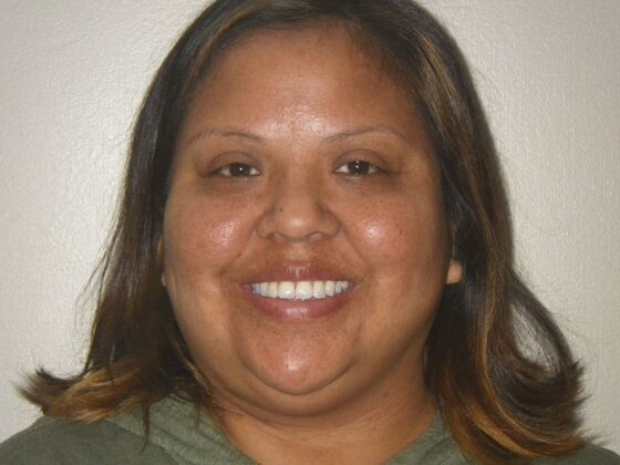 Orthodontics Case 40 - Before