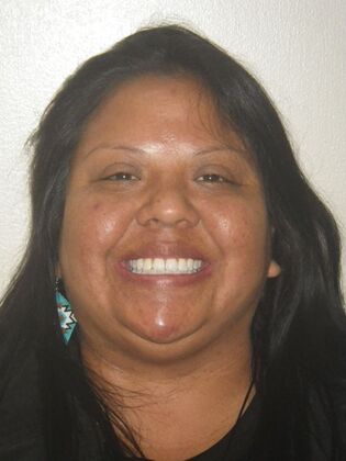 Orthodontics Case 40 - After