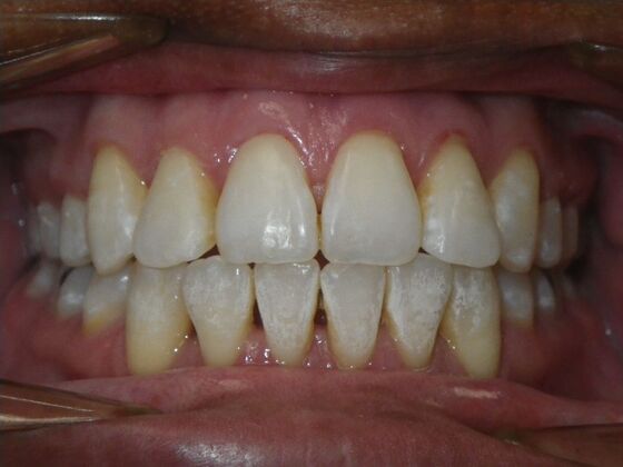 Orthodontics: Case 40 - After