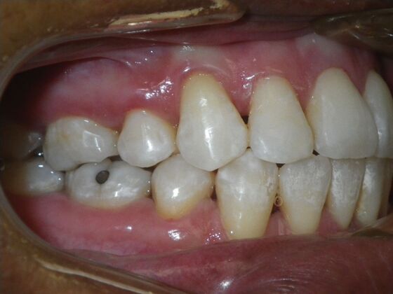 Orthodontics: Case 40 - After