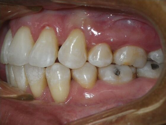 Orthodontics: Case 40 - After