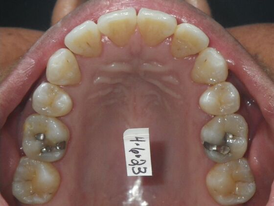 Orthodontics: Case 40 - After