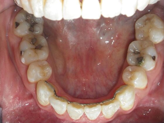 Orthodontics: Case 40 - After