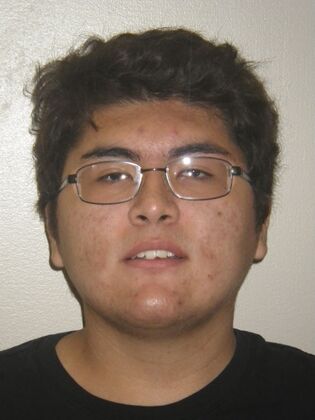 Invisalign: Case 15 - Before