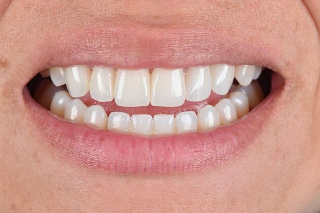 Cosmetic Cases Case 5 - After