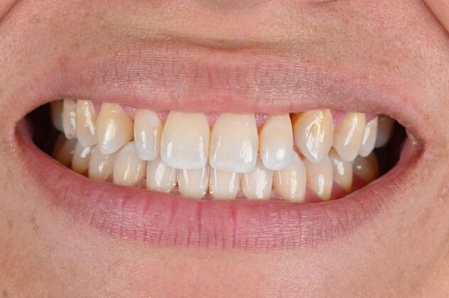 Cosmetic Cases Case 5 - Before