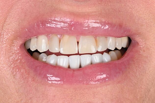 Cosmetic Cases Case 6 - Before