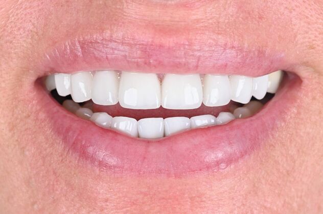 Cosmetic Cases Case 6 - After