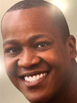 Cosmetic Bonding Rich S.  - After