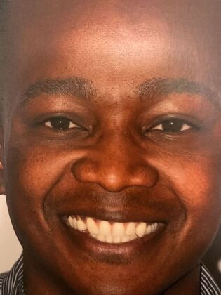 Teeth Whitening: Rich S. - Before