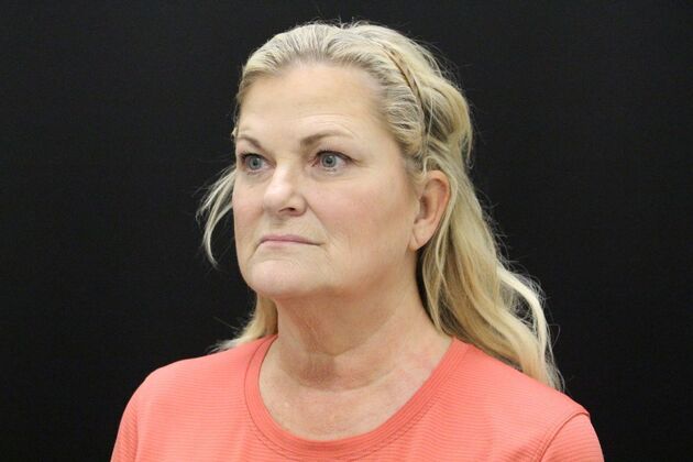 Face & Neck Lifts: Case 1 - Before