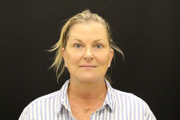 Face & Neck Lifts Case 1 - After