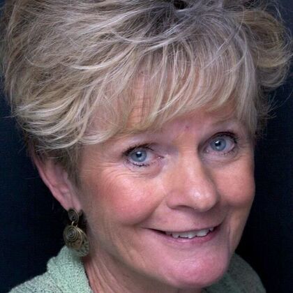 Smile Makeover Smile Makeover - Before