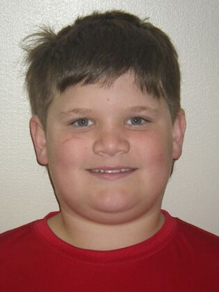 Orthodontics: Case 41 - Before