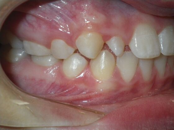 Orthodontics: Case 41 - Before