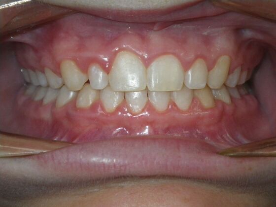 Orthodontics: Case 41 - After