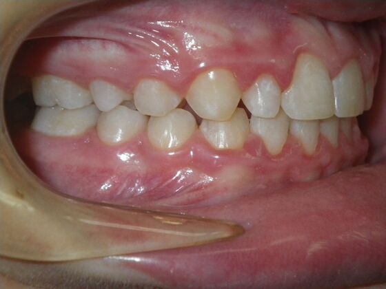 Orthodontics: Case 41 - After