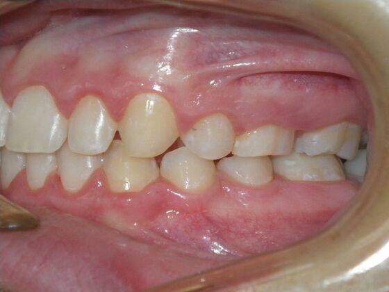 Orthodontics: Case 41 - After