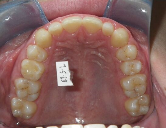 Orthodontics: Case 41 - After