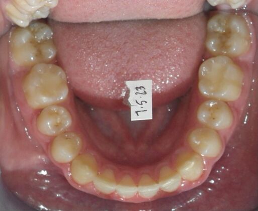 Orthodontics: Case 41 - After