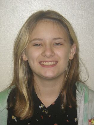 Orthodontics Case 42 - After