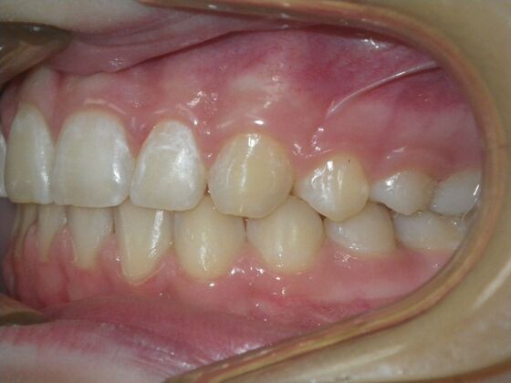 Orthodontics: Case 42 - After