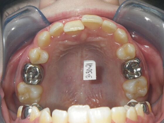 Orthodontics: Case 42 - Before