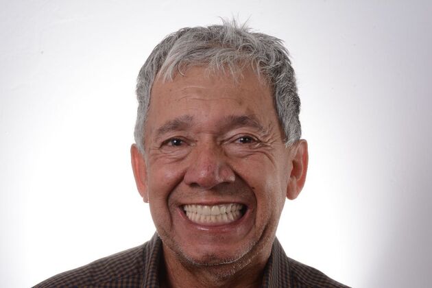 Our Results ALL ON 6 UPPER AND LOWER TEETH IN A DAY - After