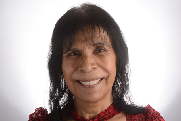 Our Results ALL ON  6 TEETH IN A DAY  - After