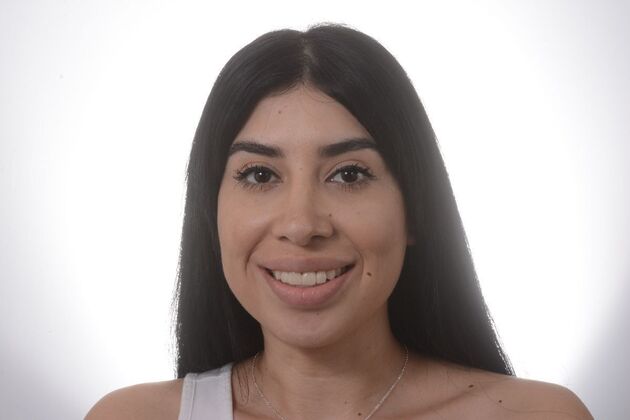 Our Results MULTIPLE IMPLANTS IN AESTHETIC AREA, TEETH IN A DAY - After