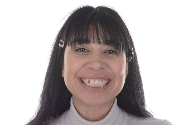 Our Results MULTIPLE IMPLANTS IN AESTHETIC AREA, TEETH IN A DAY - Before