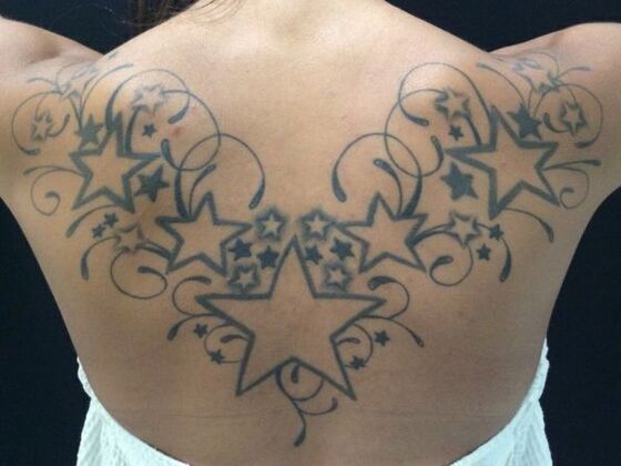 Laser Tattoo Removal Case 15 - Before